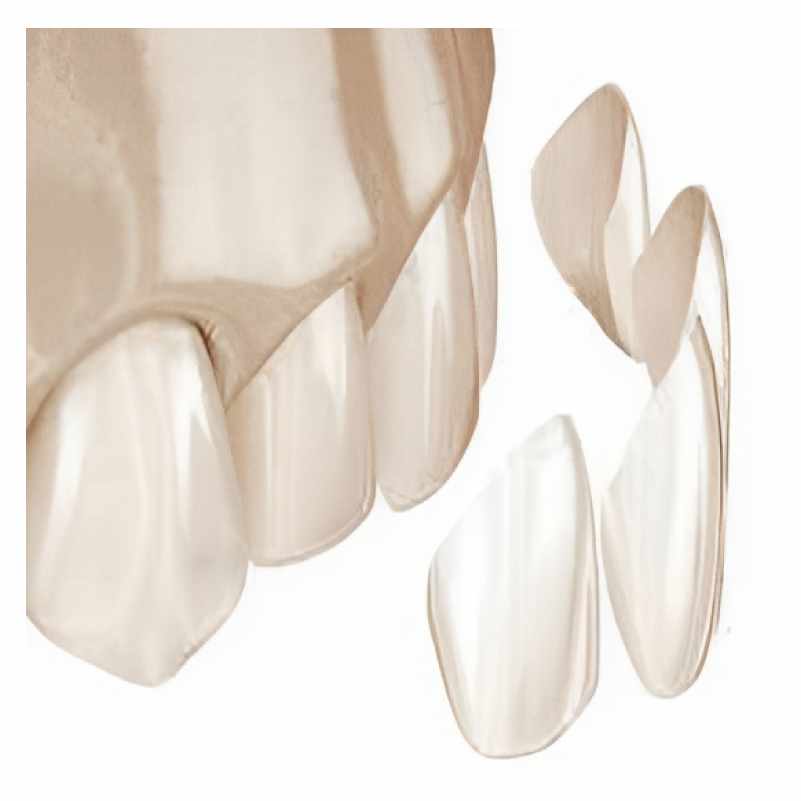 Image for Service: Crowns & Veneers